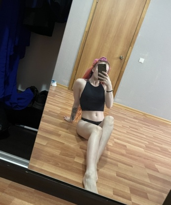 Альбина